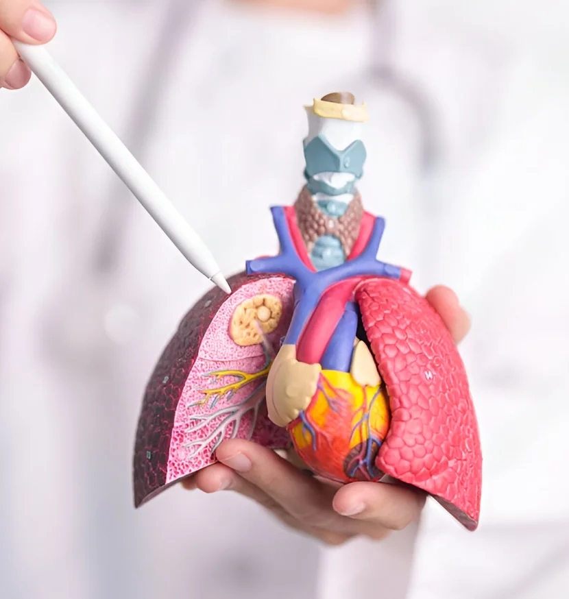 Thoracic Cancer